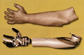 New Prosthetic Technology Connects Brain to Artificial Limb Like Never Before